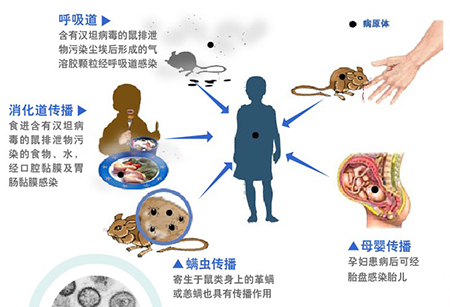 流行性出血熱你了解多少？