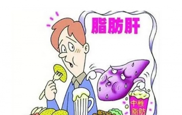 體檢查出輕度脂肪肝？想要逆轉需要做到這幾點